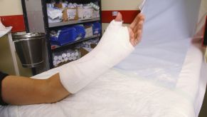 A woman with a broken left arm having a cast formed on it in white plaster. Is she still allowed to drive?