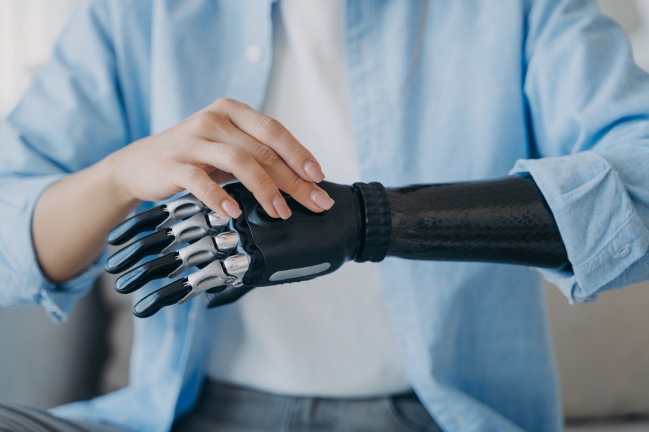 Person in a blue shirt wearing a bionic arm.